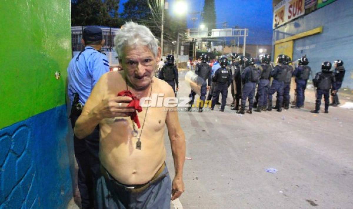 ¡Desmayados, disparos y gas lacrimógeno! El relajo en las afueras del Estadio Nacional