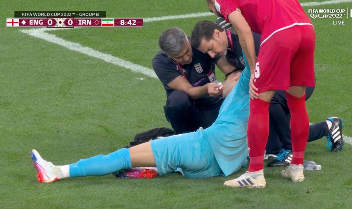 FOTOS: Portero de Irán se fue en camilla luego de recibir terrible golpe de su propio compañero en el Mundial de Qatar 2022