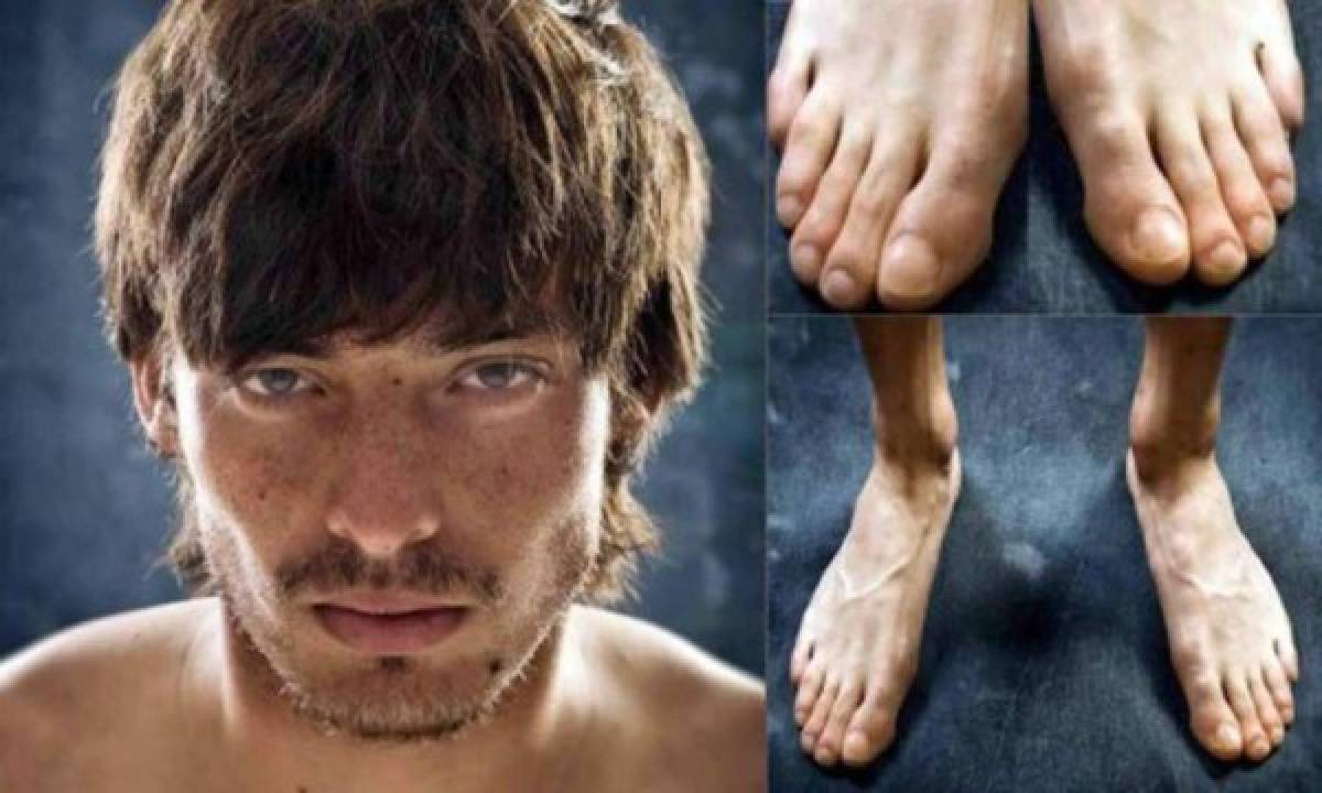 Horribles: Así son los pies más feos de los mejores futbolistas del mundo; Müller se une a la lista