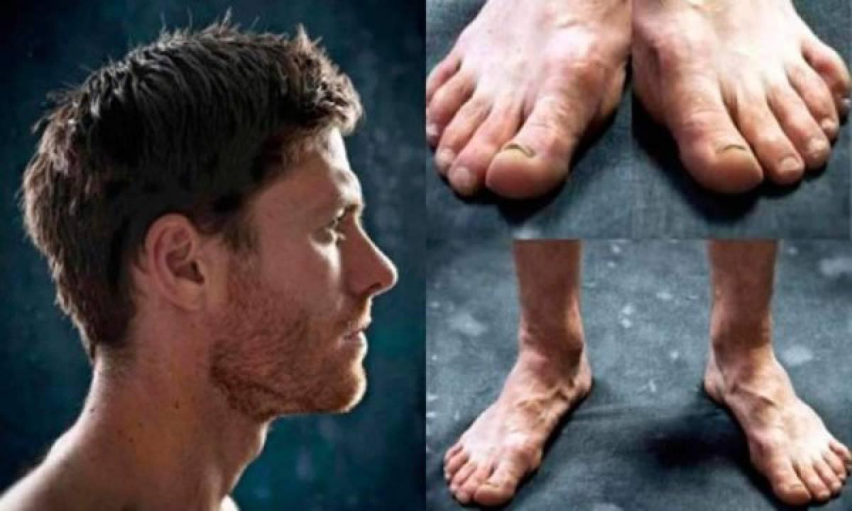 ¡Al descubierto! Así son los pies más feos de algunos deportistas reconocidos a nivel mundial; los de CR7 y Lebron son horribles