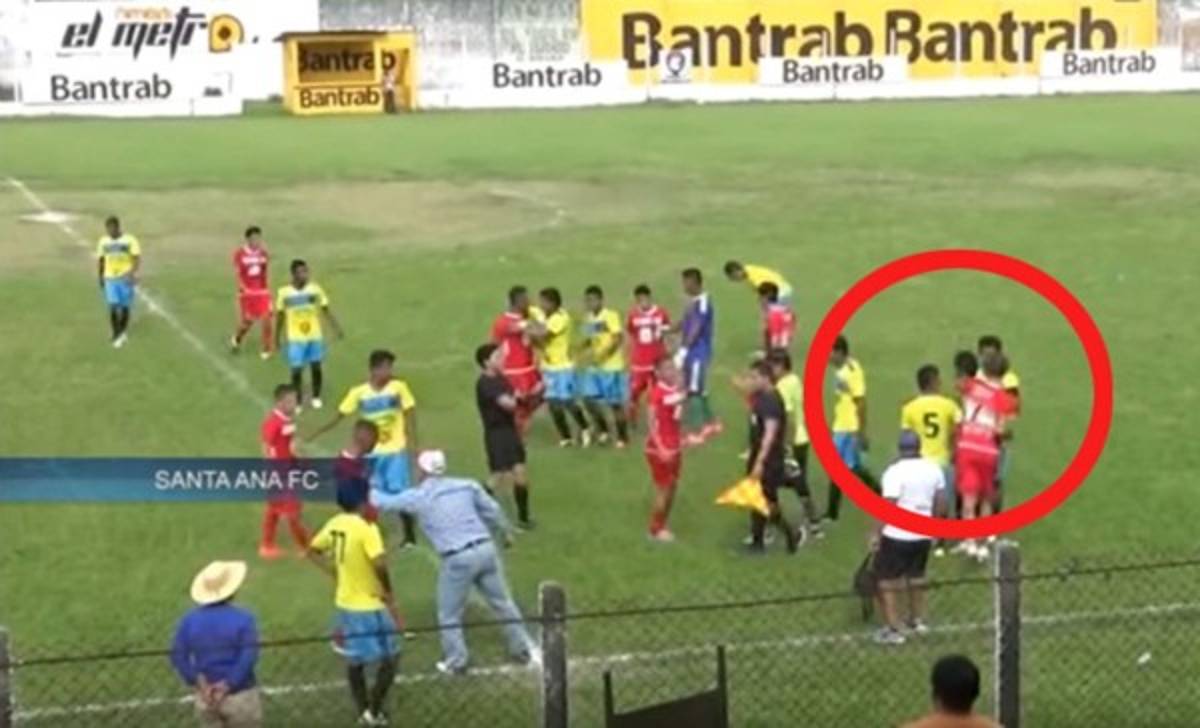 Futbolista agrede a rival y lo hace sangrar en la segunda división de Guatemala