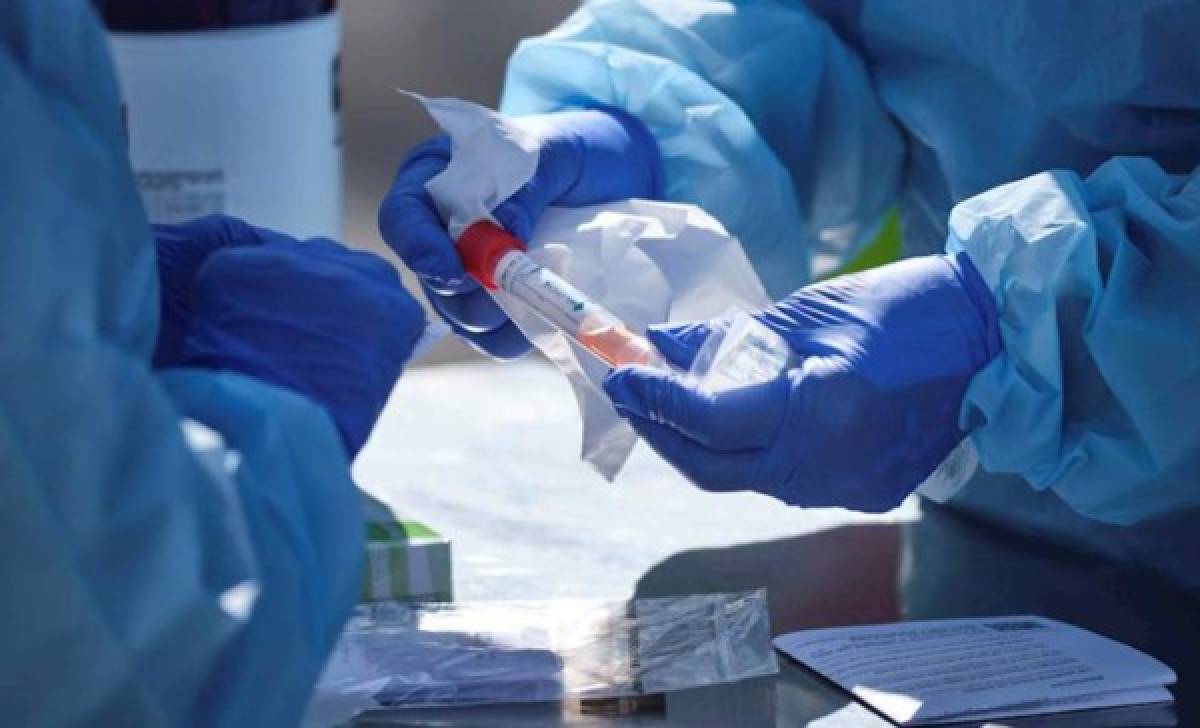 Dañadas 250 mil pruebas para coronavirus a un costo de 46 millones de lempiras