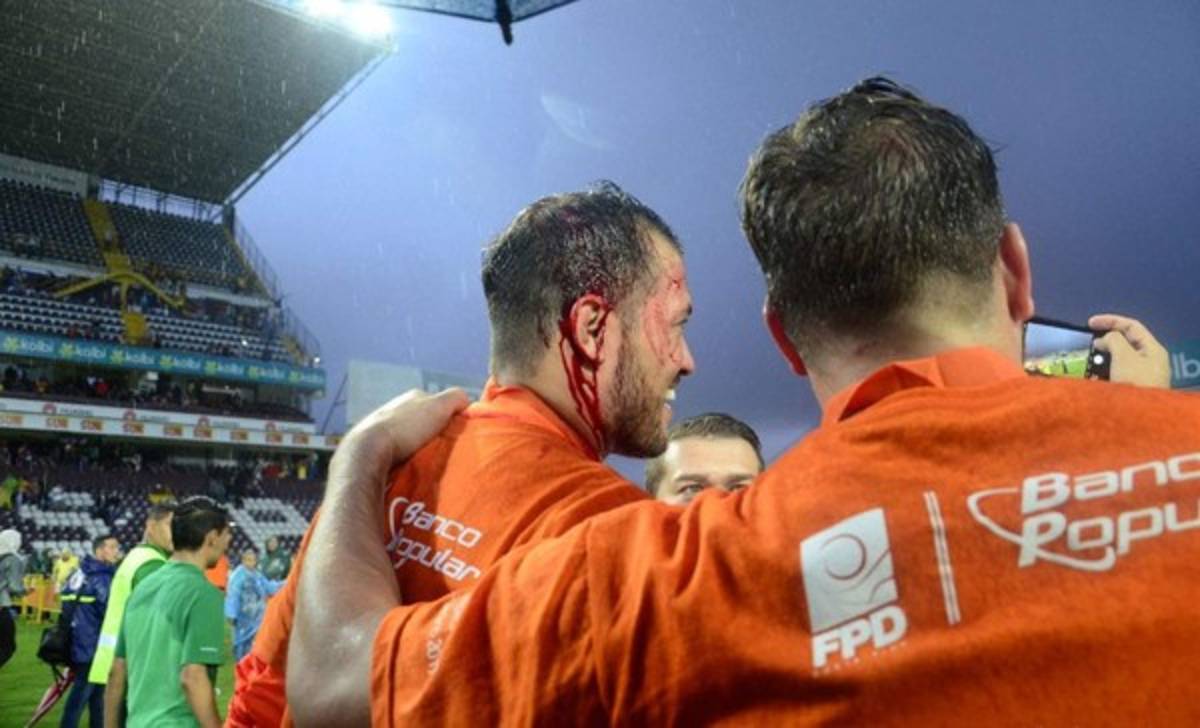 ¡Lamentable! Futbolista del Herediano fue agredido en celebración del título