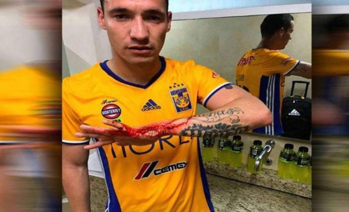 Jugador de Tigres agredido por la afición en México