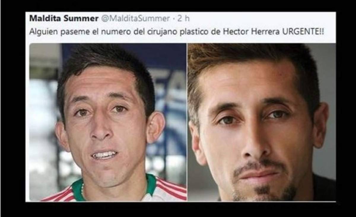 ¡Héctor Herrera es acribillado con memes tras sus cirugías plásticas!