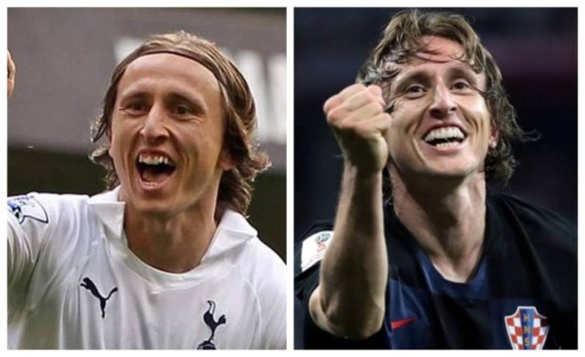 Cristiano Ronaldo el más llamativo: Deportistas famosos a los que el dentista les cambió la vida  