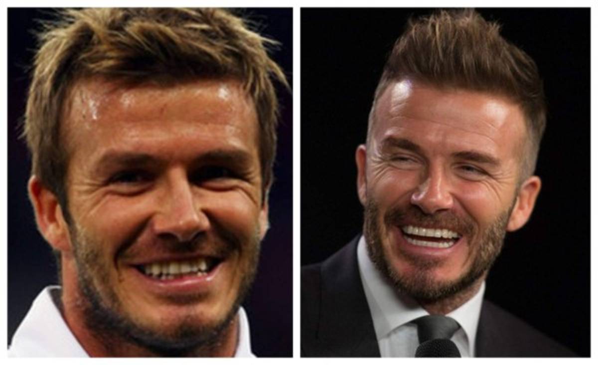 Cristiano Ronaldo el más llamativo: Deportistas famosos a los que el dentista les cambió la vida  