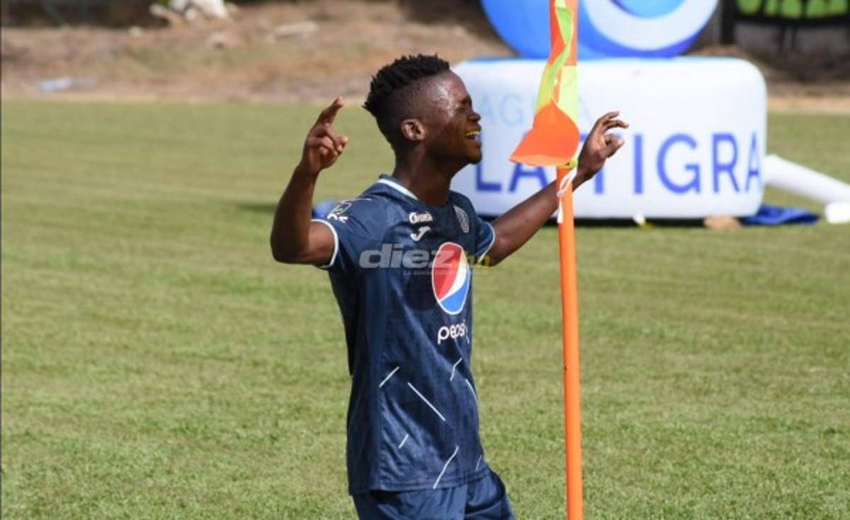 No se vio en TV: El 'chofer' de Olimpia, la nueva kinesióloga de UPNFM y Arboleda estalló por racismo