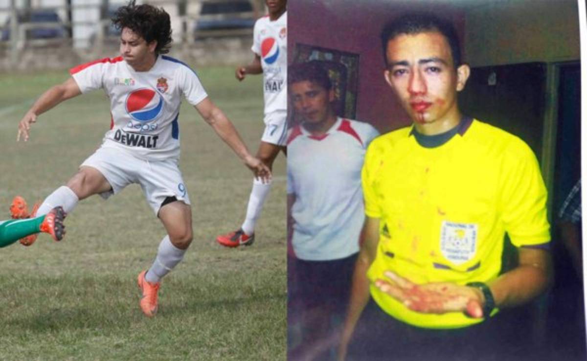 ¡Ya paren! Las repudiables agresiones a los árbitros en el fútbol hondureño