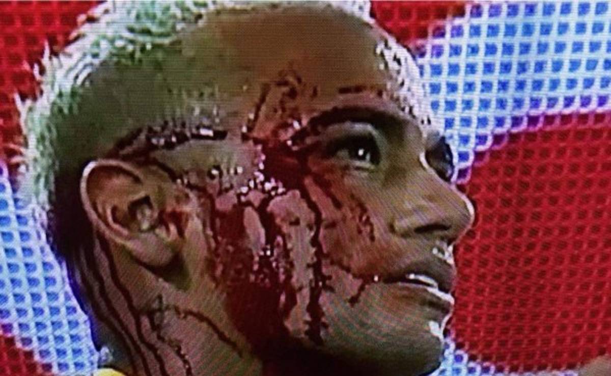 Brutal codazo de boliviano que dejó sangrando a Neymar ¡Y no le pitaron ni falta!