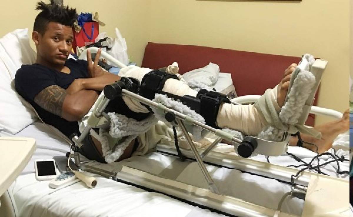 ¡Luis Garrido ya dobla la rodilla a 70 grados luego de 14 días de su lesión!