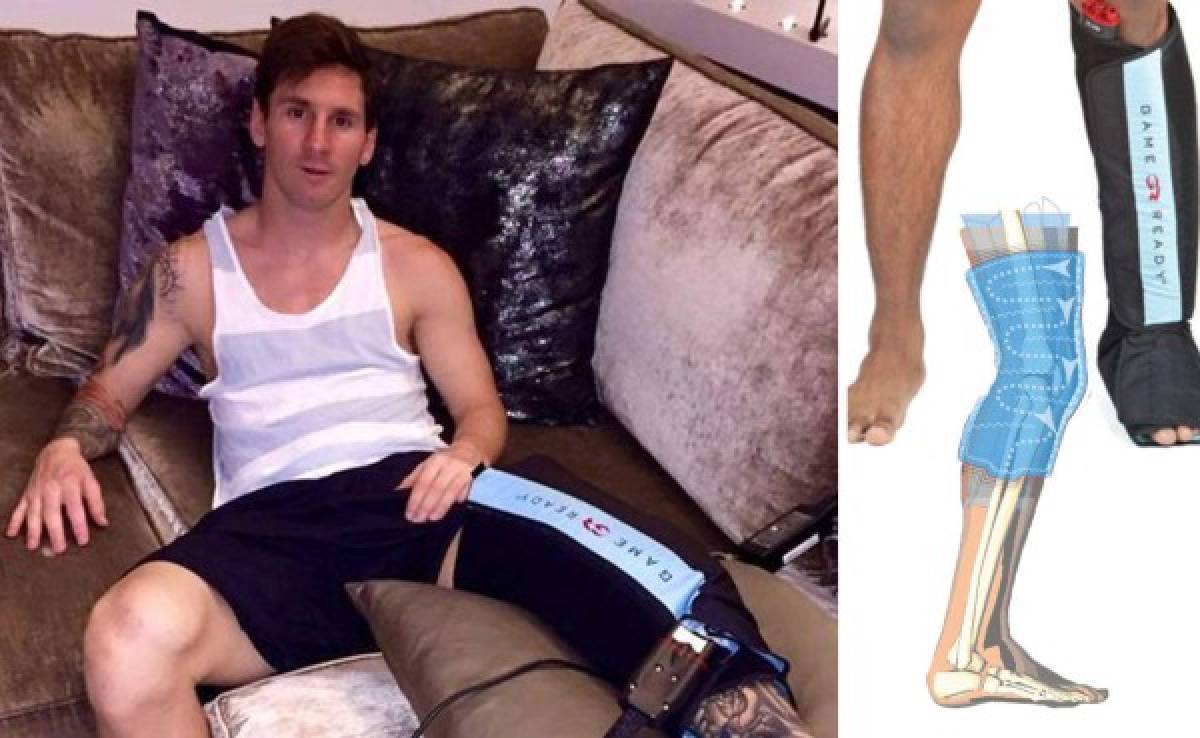 FOTOS: Así funciona el Game Ready, la tecnología con la recuperan a Messi