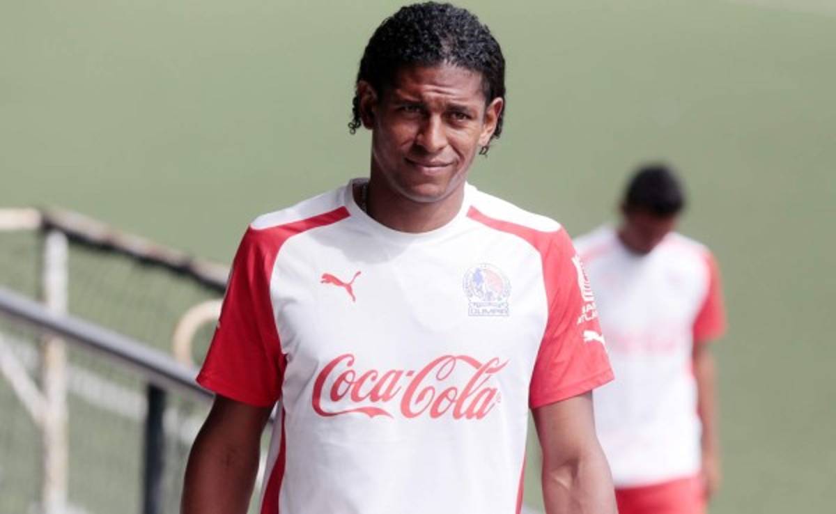 Se confirma baja de Carlo Costly por dos semanas