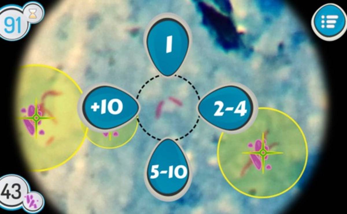 La tuberculosis podría ser detectada por medio de un videojuego