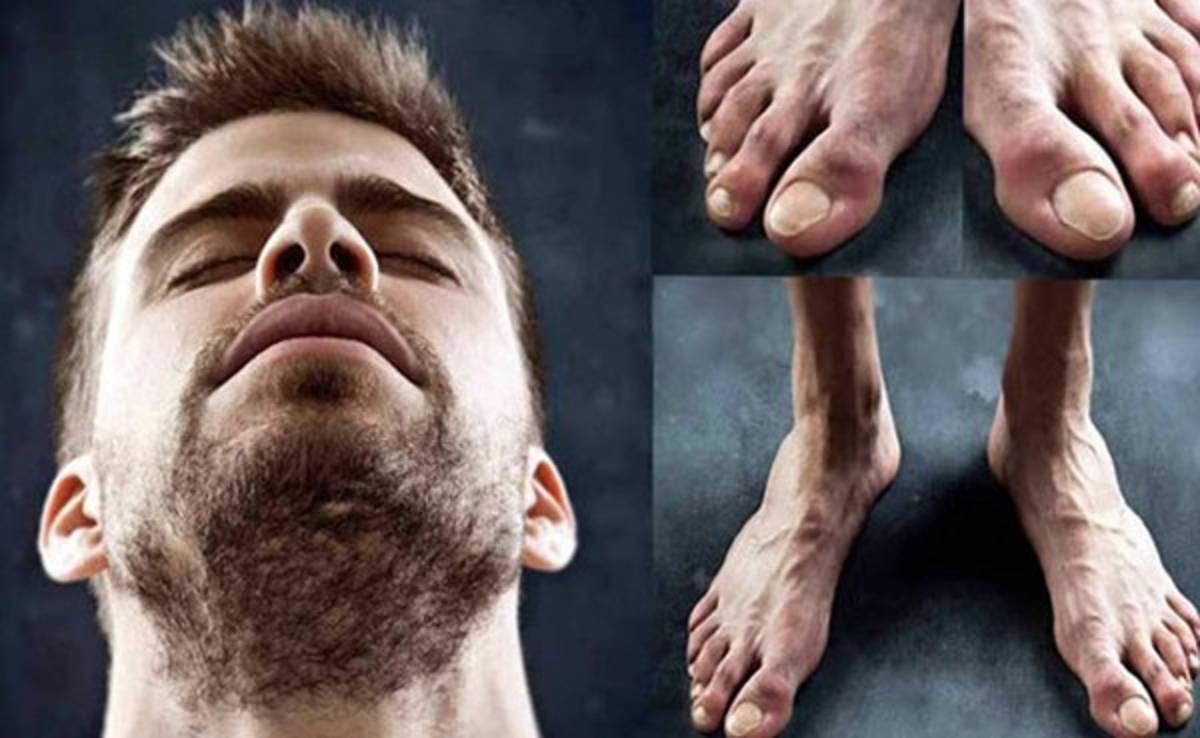 Los pies más feos de los futbolistas en el mundo