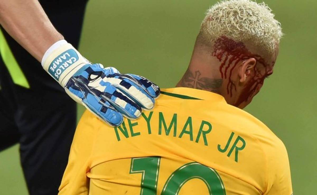 Neymar reacciona tras el codazo: 'A seguir la fiesta, no pasa nada'