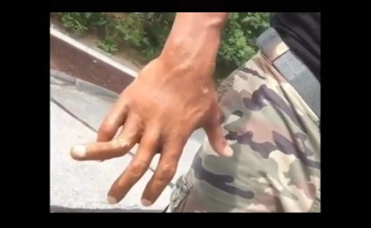 VIDEO: La Roca se disloca un dedo y sigue sonriendo como si nada