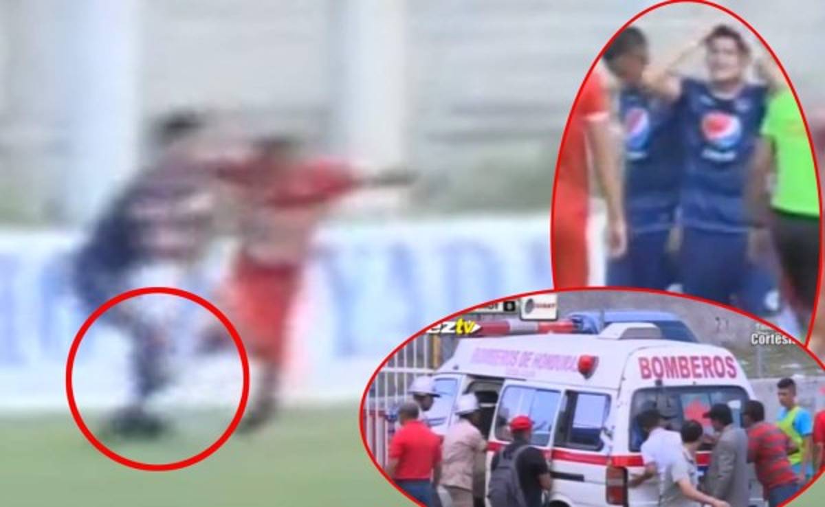 VIDEO: Martín Pucheta de Motagua sufre horrible lesión de tobillo