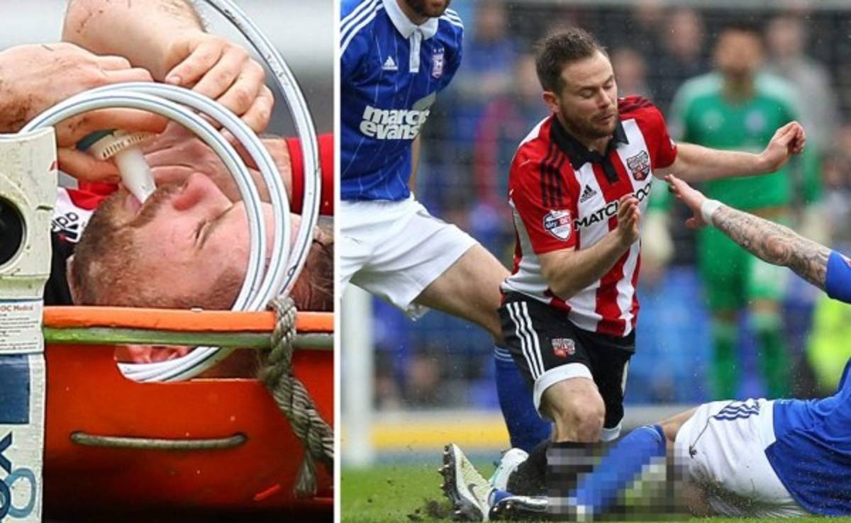 VIDEO: Alan Judge se perdería la Eurocopa por terrorífica lesión