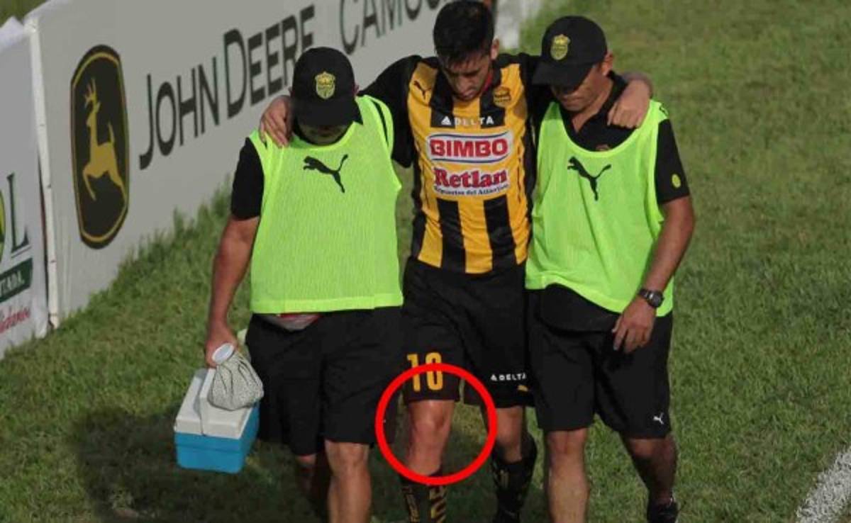 Luciano Ursino se pierde el resto del torneo con Real España