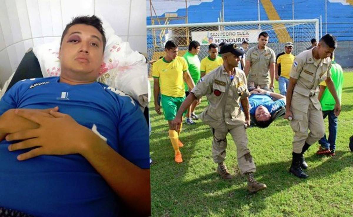 Portero de Liga Mayor de Honduras se lleva el susto de su vida