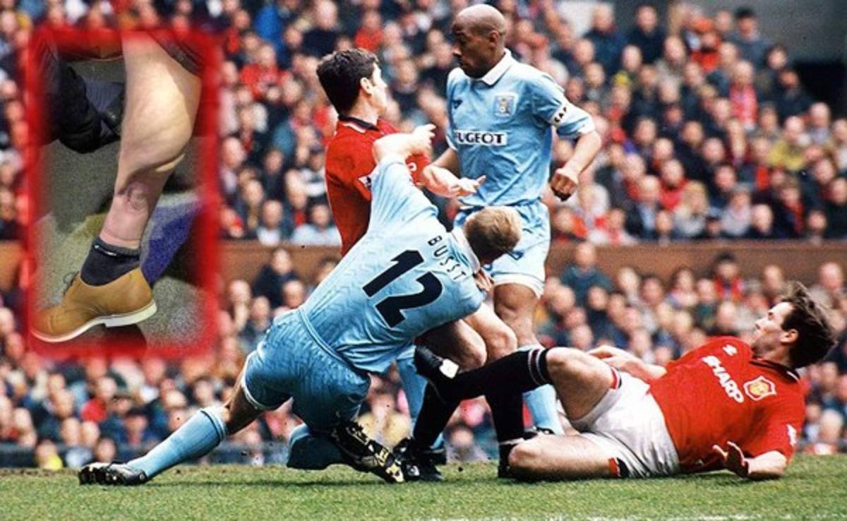 Luego de 20 años decide enseñar las secuelas de una lesión que lo retiró