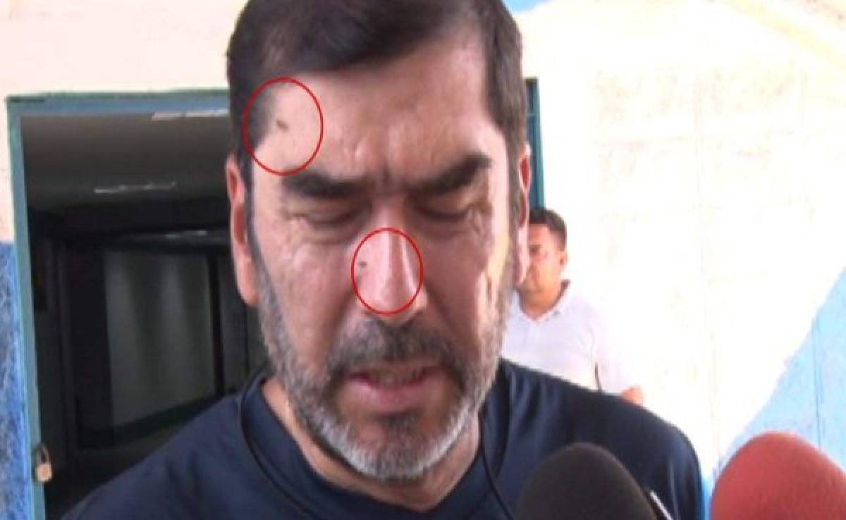 VIDEO CURIOSO: Las moscas intrusas en las entrevistas de la Selección de Honduras