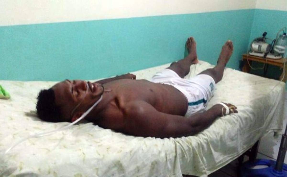 Panameño Richard Dixon es hospitalizado tras juego en Tocoa