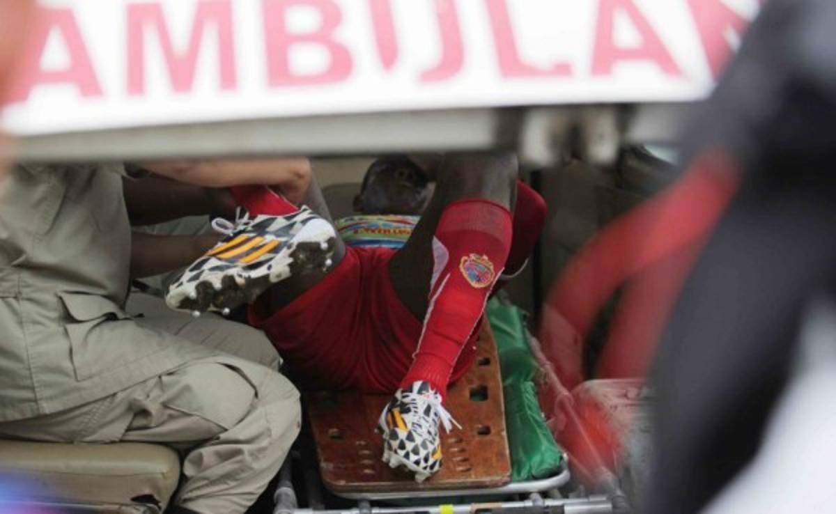 Robbie Matute sufre escalofriante lesión ante Platense