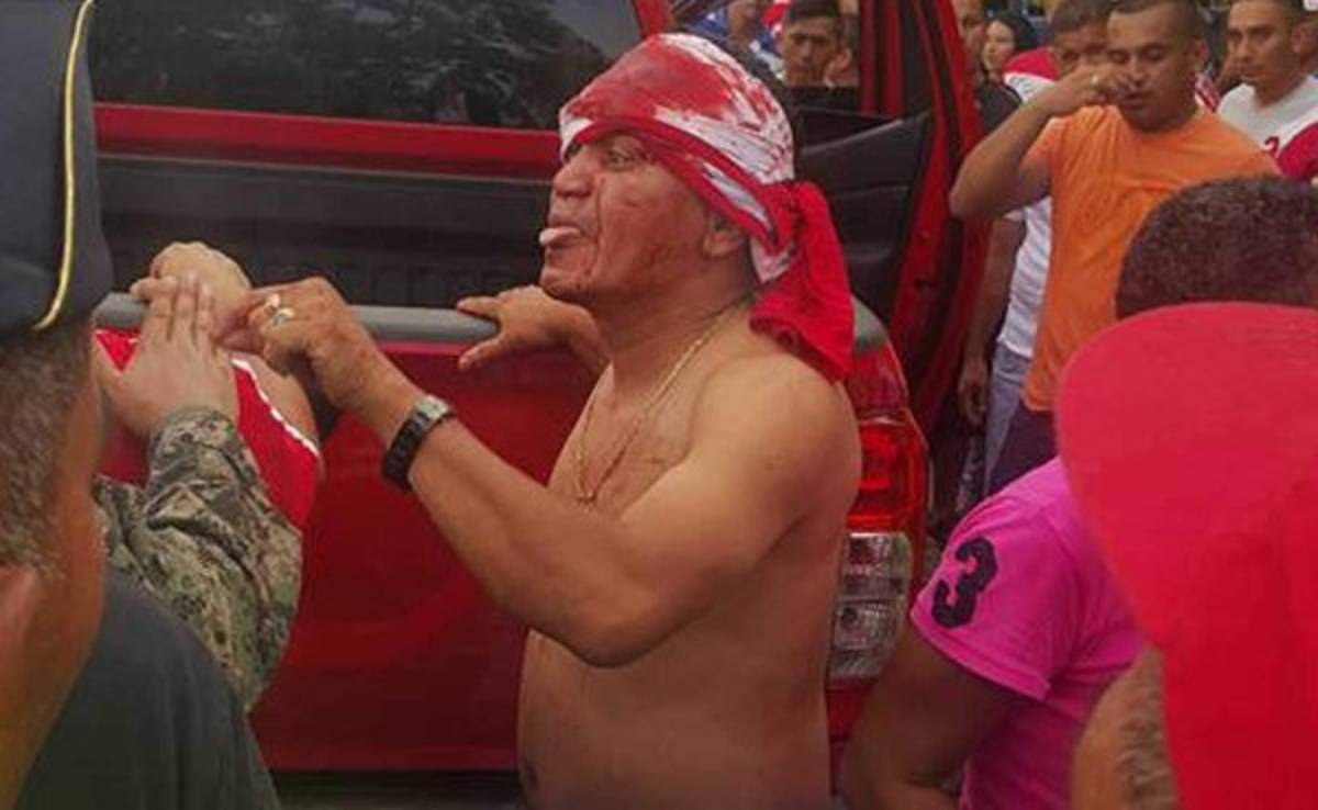 El zafarrancho que se armó tras el juego entre Olimpia y Real Sociedad