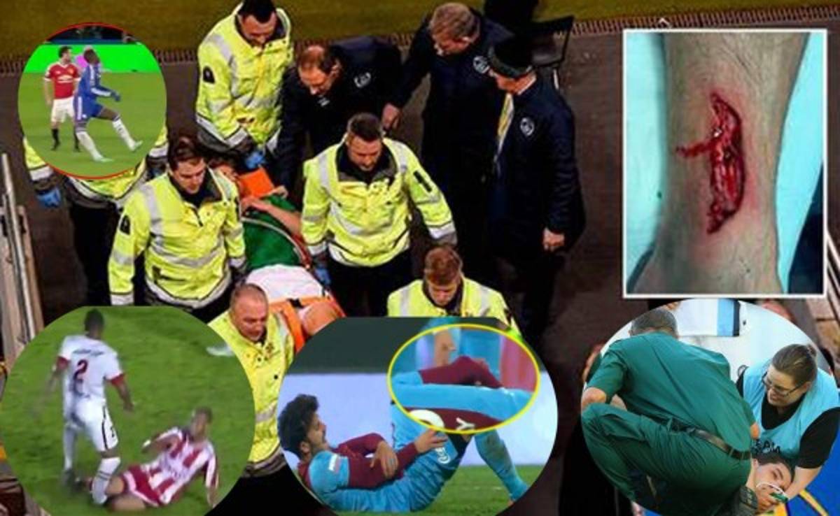 Estas son las peores lesiones de futbolistas en lo que va de 2016