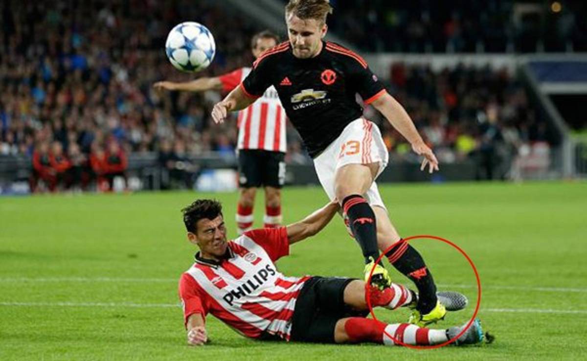 VIDEO: Horrible y escalofriante fractura de Héctor Moreno a Luke Shaw