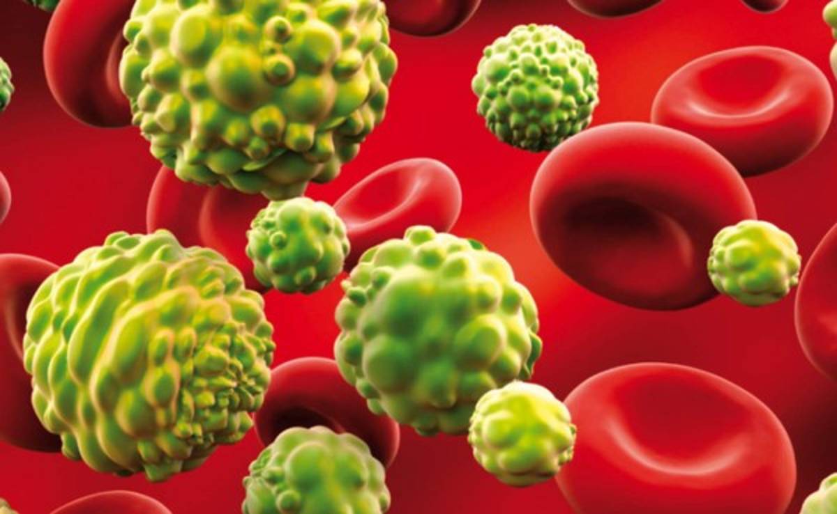 Encuentran un fármaco que reduce la expansión del cáncer de mama más agresivo