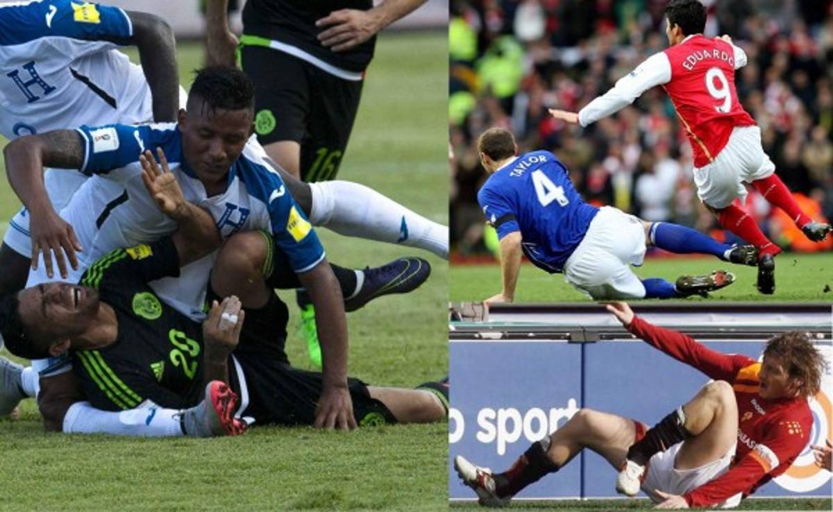 Futbolistas que vencieron las lesiones más escalofriantes del fútbol