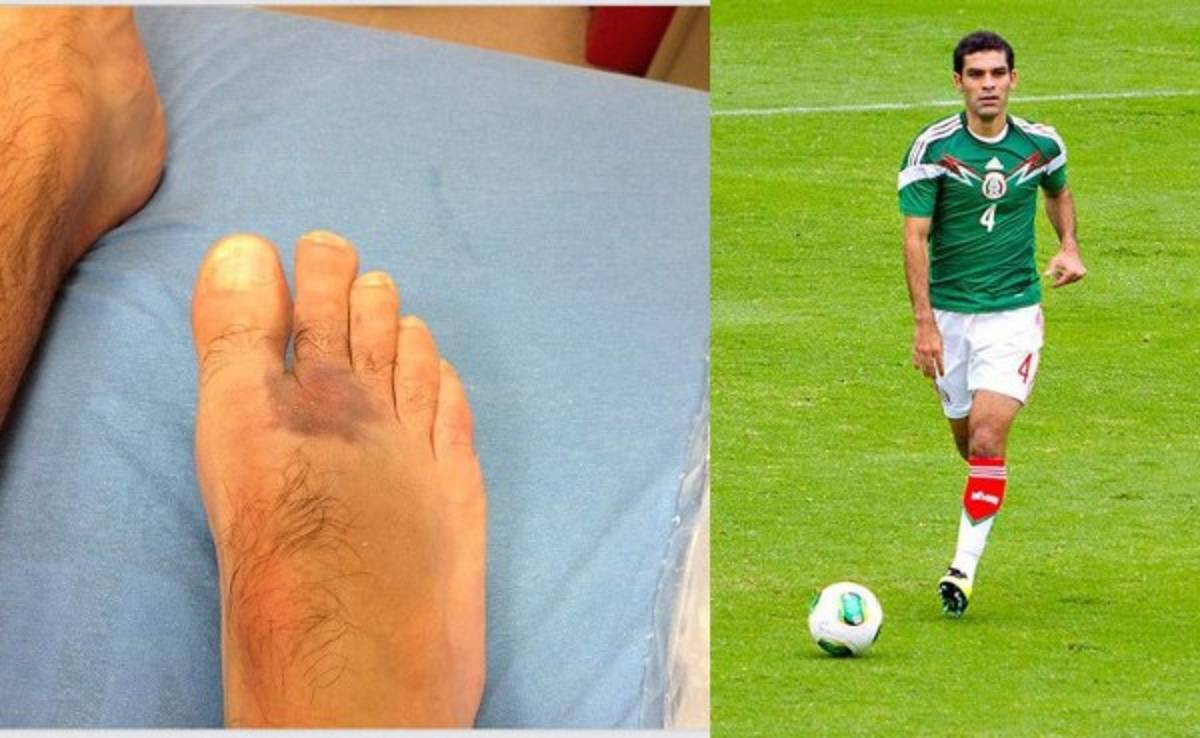 VIDEO: Lesión del mexicano Rafa Márquez no es grave