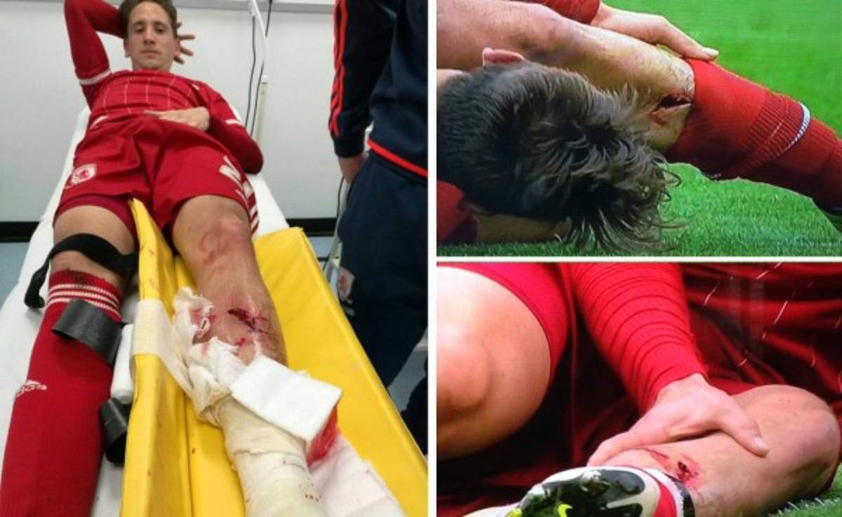 VIDEO: La terrible lesión que sufrió Gastón Ramírez en el ascenso del Middlesbrough