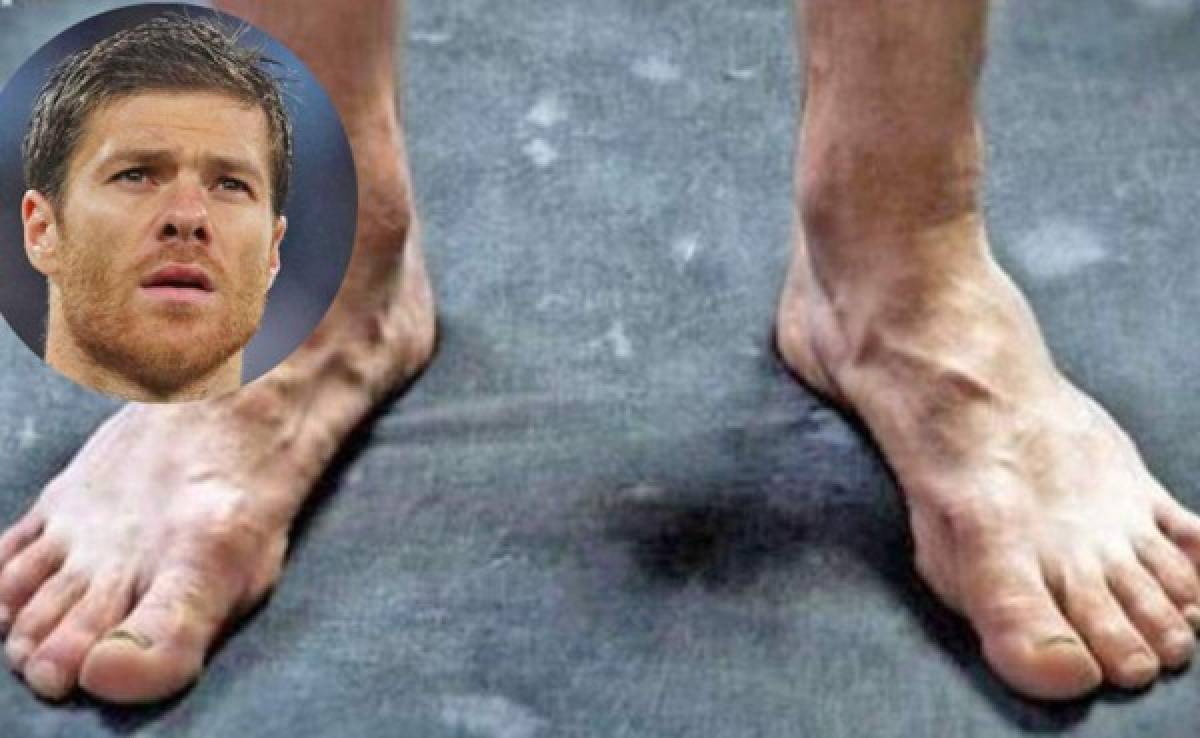 Horribles: Así son los pies más feos de los mejores futbolistas del mundo; Müller se une a la lista