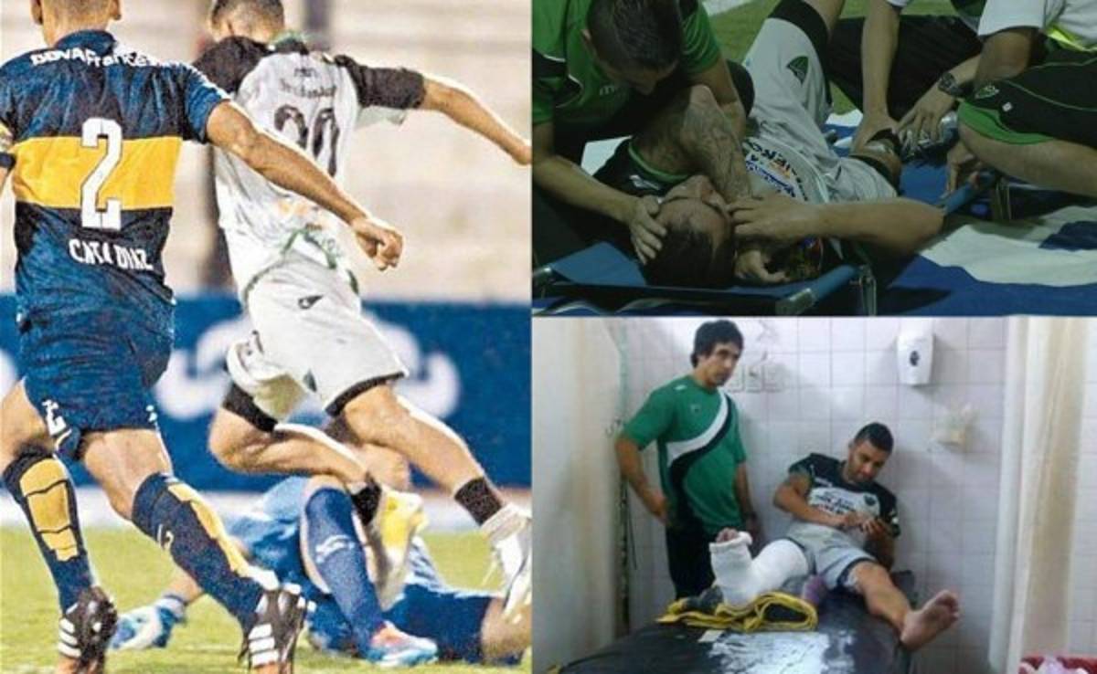 VIDEO: Portero de Boca Juniors le fractura tibia y peroné a rival