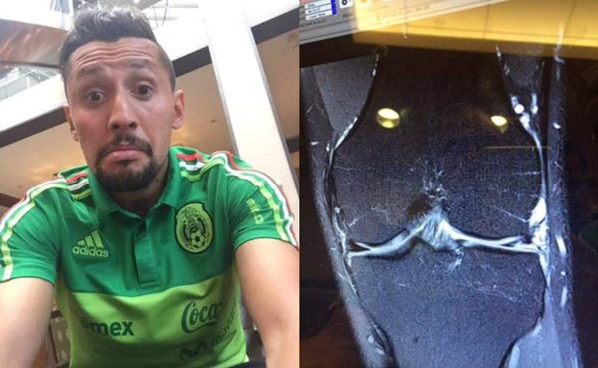 México pierde a Yasser Corona por el resto de la Copa Oro