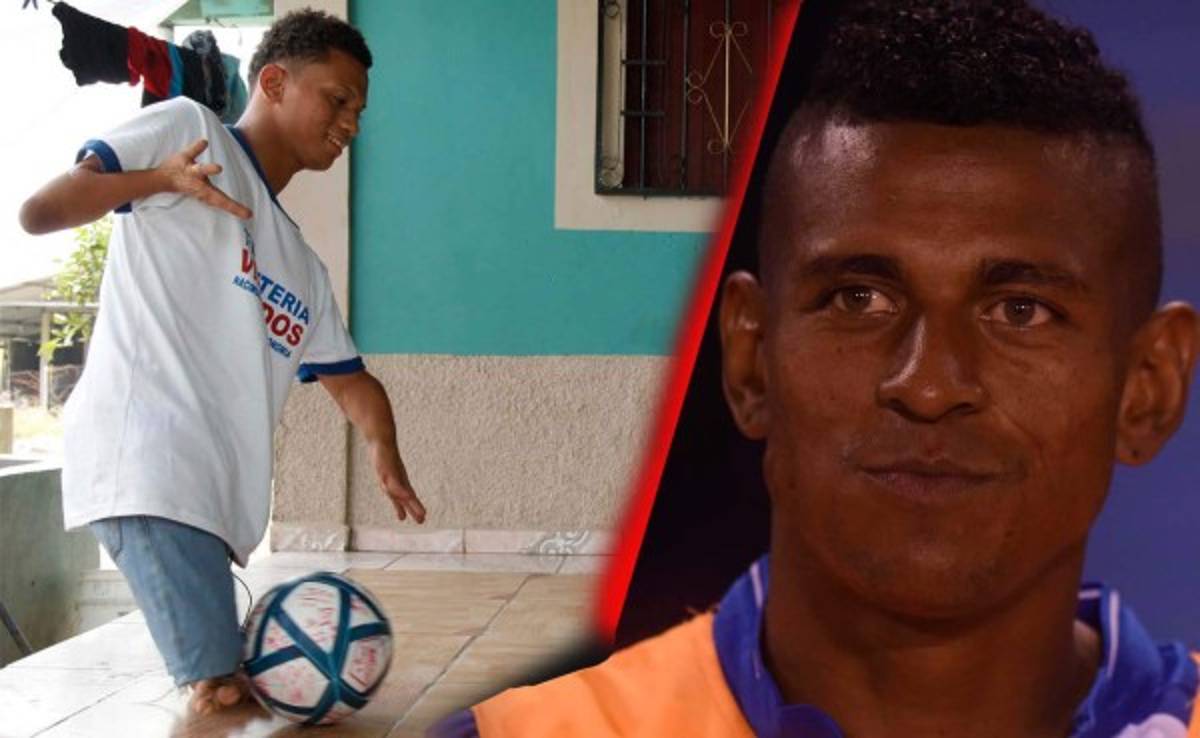 Video: Conocer a Carlo Costly, el gran sueño de Elmer Espinal