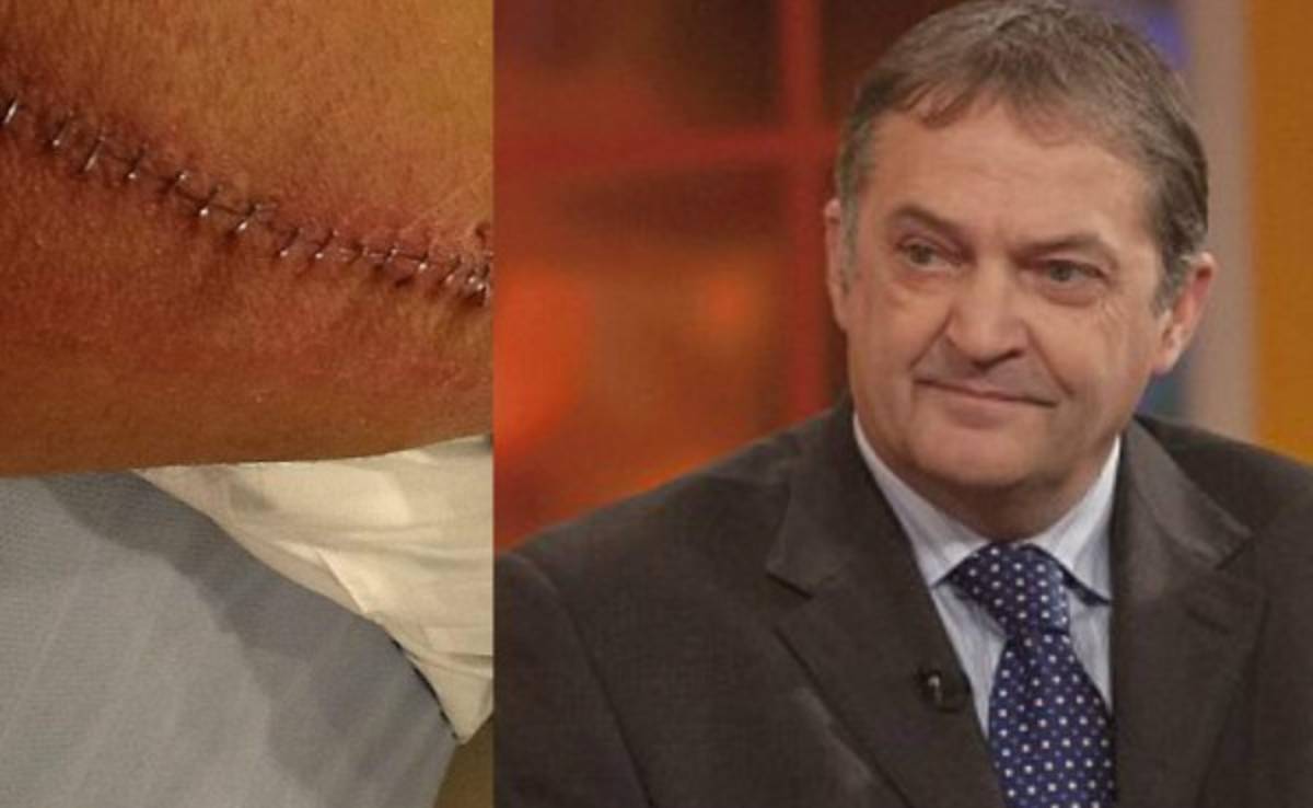 Ex jugador del Tottenham muestra las 112 grapas tras operarse la pierna