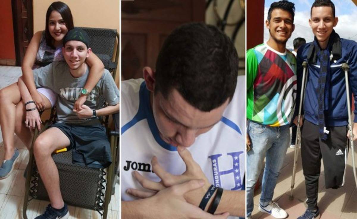 Luis Diego Jiménez, el futbolista hondureño que sonríe a pesar de haber perdido una pierna