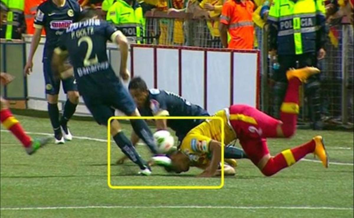 VIDEO: Cristian Lagos no sufre daño cerebral tras patada de Goltz