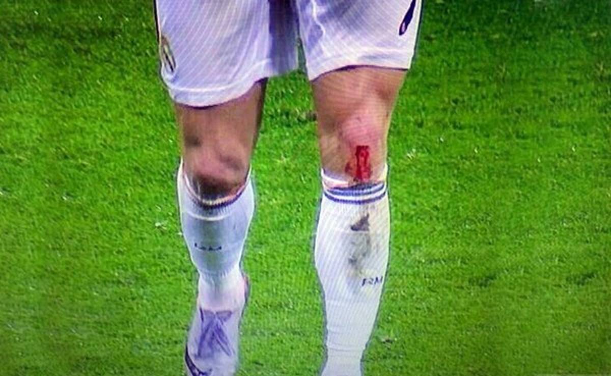 VIDEO: Cristiano terminó juego ante Rayo con rodilla ensangrentada