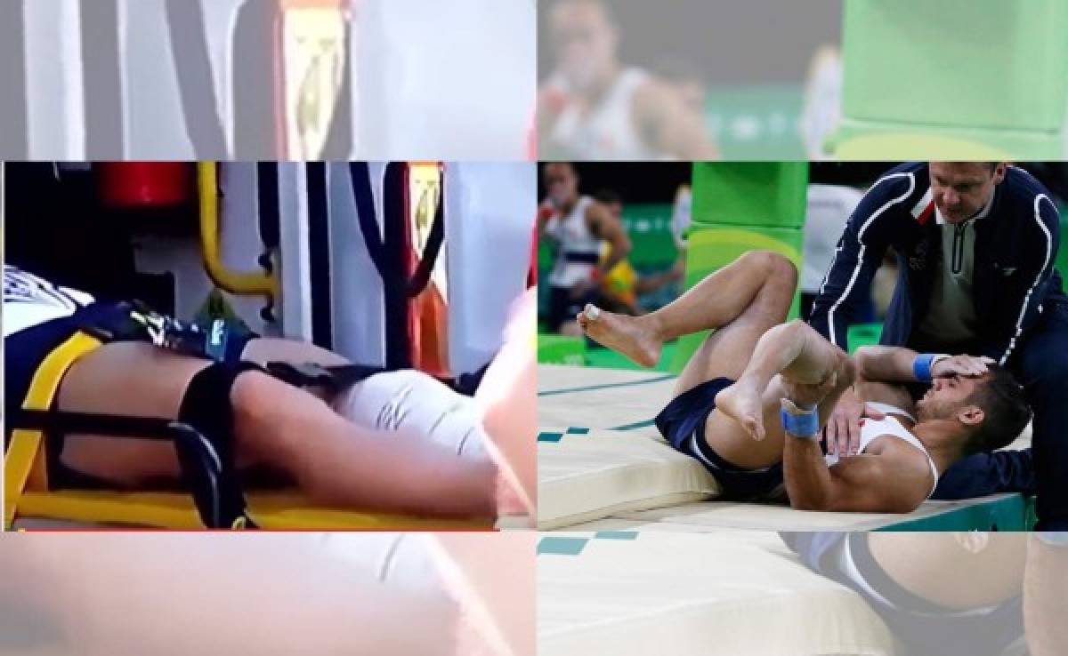 VIDEO: Gimnasta que se partió la pierna fue dejado caer por los paramédicos
