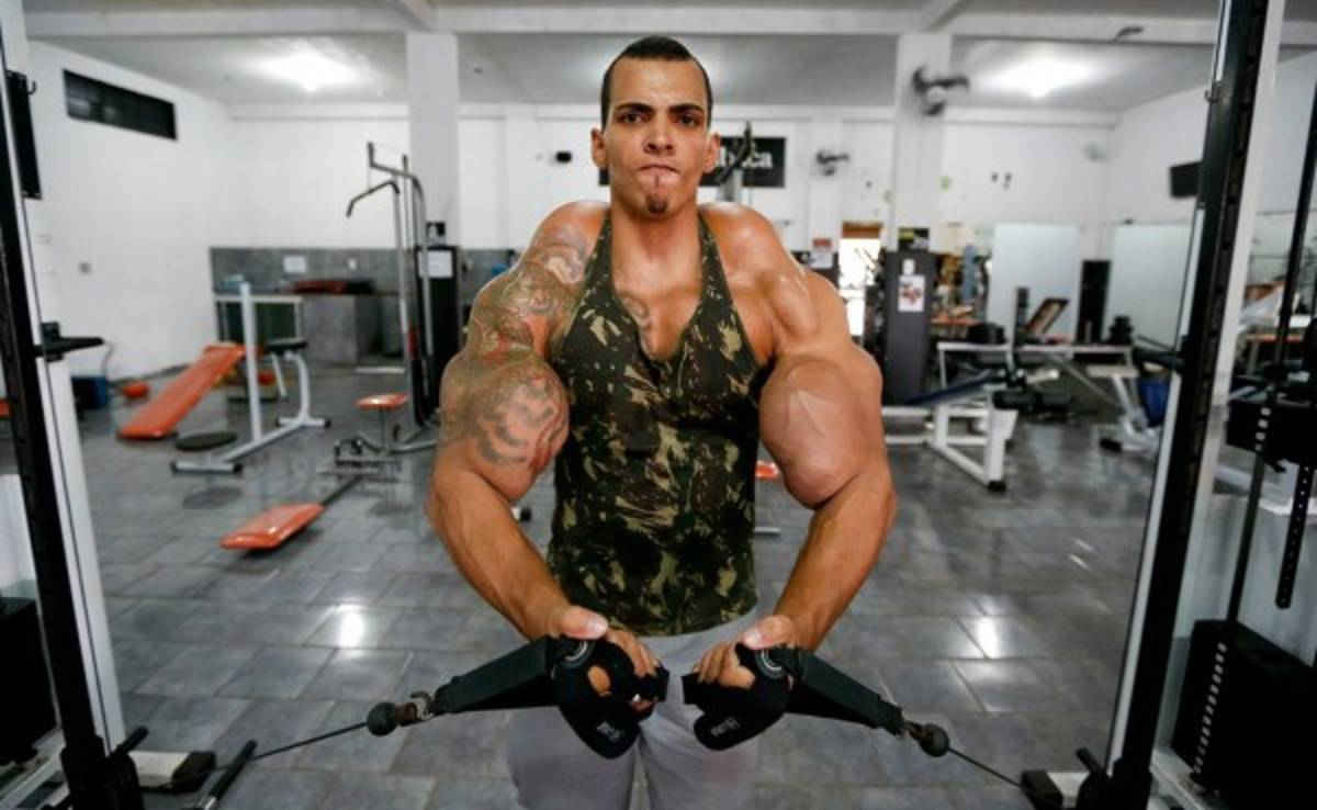 El 'Hulk humano' tuvo que desinflarse los brazos para no perderlos