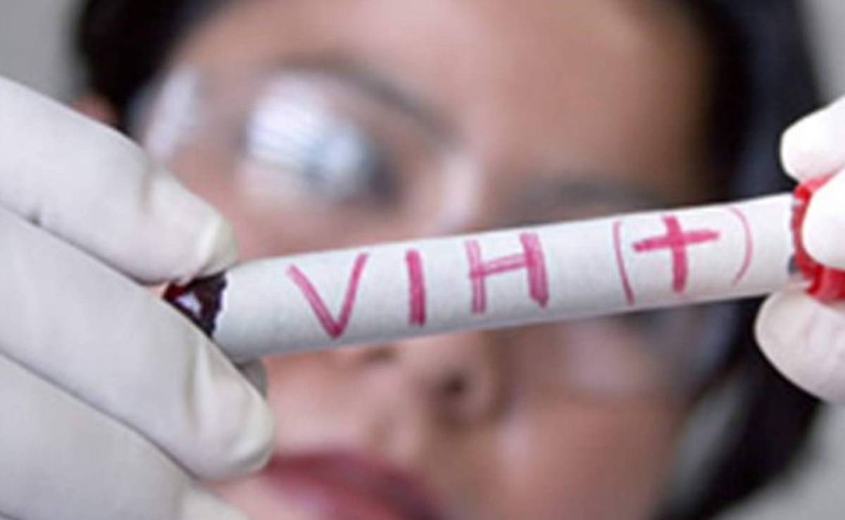 Un hombre británico consigue ser curado de VIH