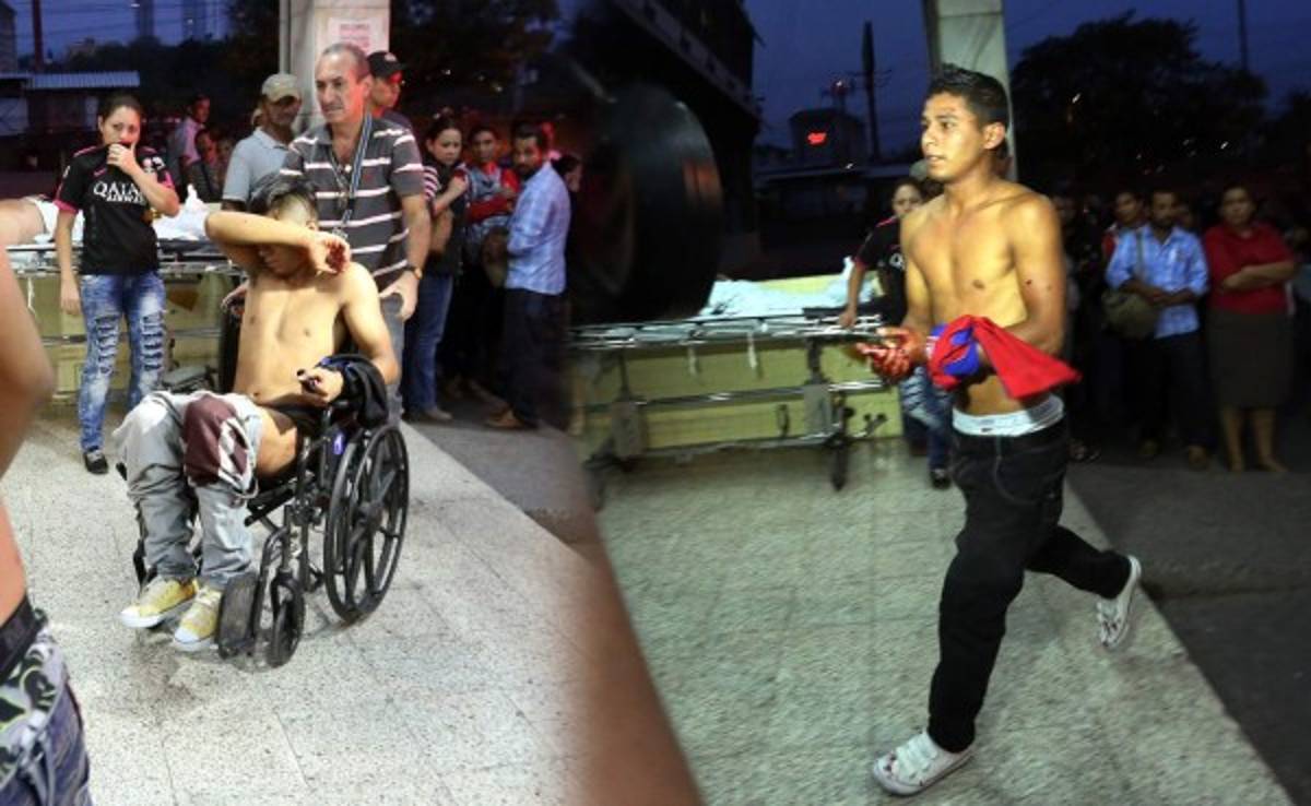 Lamentable: Tres heridos de bala tras triunfo de Olimpia ante Motagua en Honduras