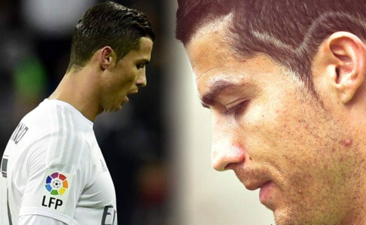 Cristiano Ronaldo no jugará ante el Manchester City por lesión