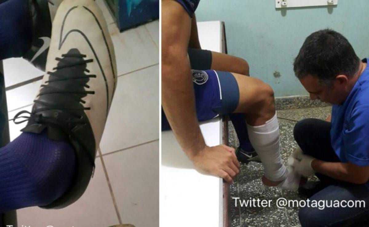 CONFIRMADO: Martín Pucheta sufre rotura de ligamento de tobillo derecho